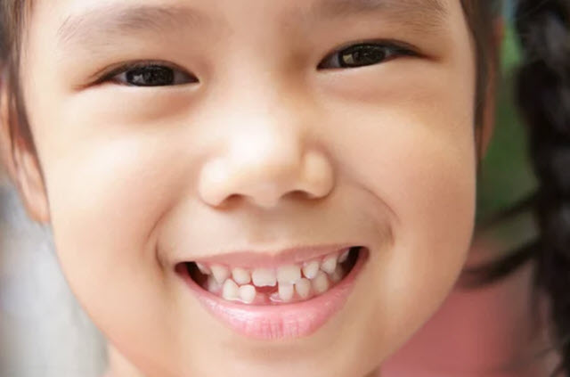 odontopediatria dientes niños